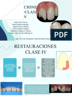 Restauraciones clase IV y V-Grupo 2 (1)