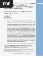 63. alças de retração retracao retraçao