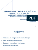 Neurorradiología