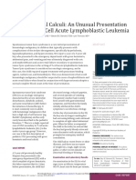 Renal Calculi: An Unusual Presentation of T-Cell Acute Lymphoblastic Leukemia