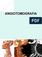 ANGIOTOMOGRAFIA-1