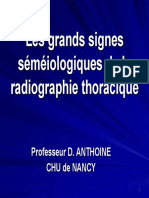 Signes Sémiologiques Indispensables en Radiographie Du Thorax