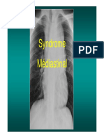 Syndrome Médiastinal