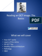 Reading An OCT Image-The Basics