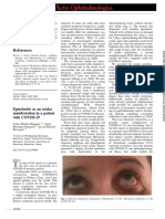 Episcleritis As An Ocular Manifestation in A Patient With COVID 19