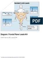 Diagram: Frontal Plane Leads-KH