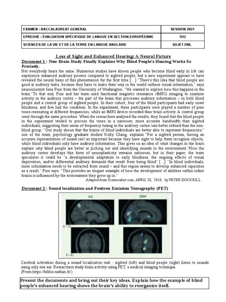 Blindness and Enhanced Auditory Perception | PDF | Visual Impairment ...