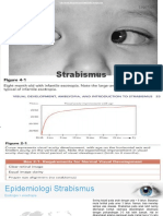 Strabismus FX