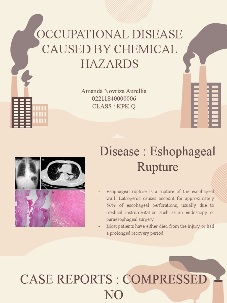 Chemical Hazards and Esophageal Injury | PDF | Esophagus | Medical ...