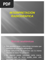Interpretación radiográfica