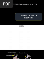 UNIDAD 2 Componentes de La Prótesis Parcial Removible