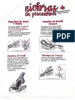 Maniobras placentarias