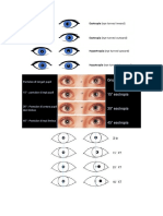 Hirschberg Test