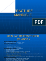 Mandibular Fractures