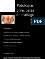 Patologia de Esofago