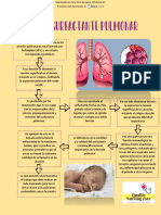 Surfactante Pulmonar 2 Downloable