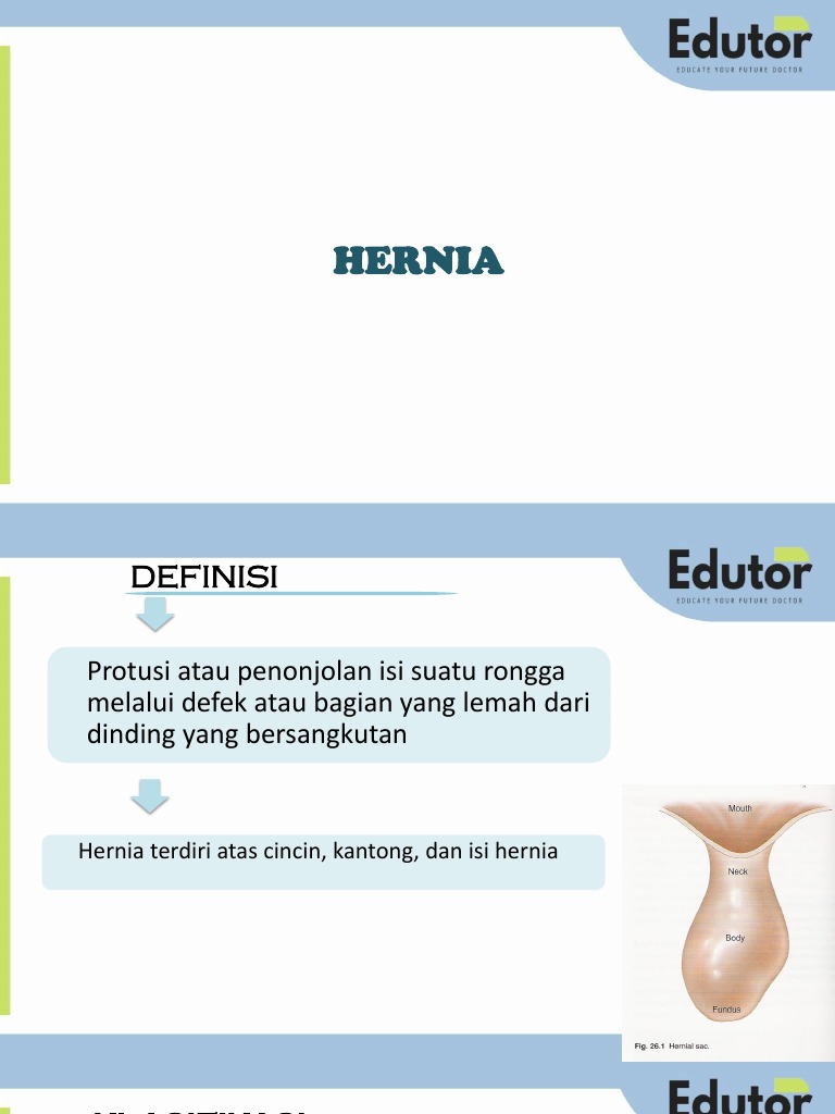 hernia-pada-anak-pdf