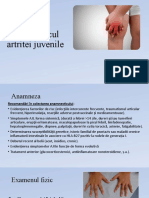 artrita juvenila diagnostic