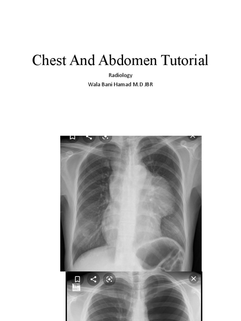Tutorial Chest and Abdomen | PDF | Wellness