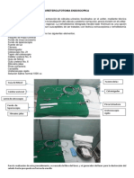 URETEROLITOTOMIA