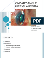 Secondary Angle Closure Glaucoma: Sristi Thakur 2 Year Resident Lei, Nams