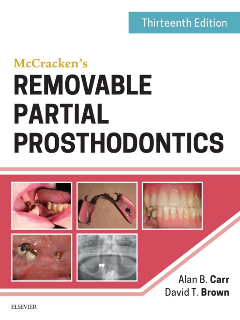 McCracken's Removable Partial Prosthodontics PDF Dentures Dental