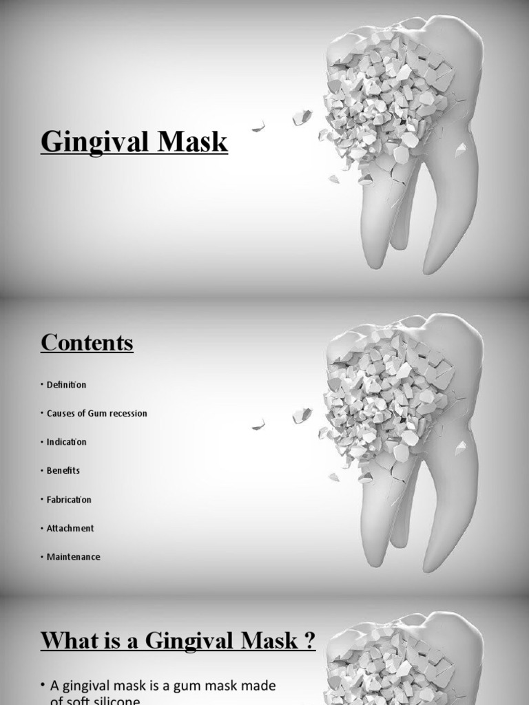 Gingival Mask PDF Mouth Dentistry