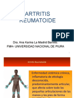 ARTRITIS REUMATOIDE