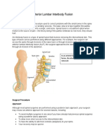 Alif Surgical Procedure