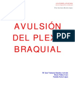 Avulsión Plexo Braquial