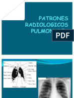 PATRONES-RADIOLOGICOS-PULMONARES