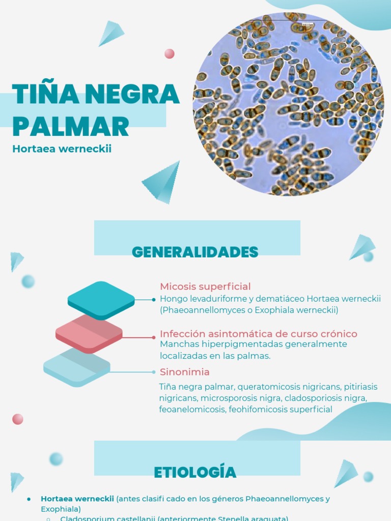 Tiña Negra Palmar | PDF | Inmunología | Ciencias de la Salud