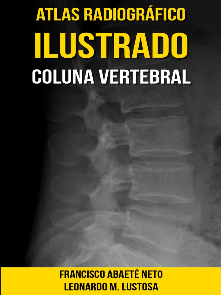 Atlas Radiográfico Ilustrado Coluna Vertebral | PDF | Coluna vertebral |  Vértebra, image size:768x1024