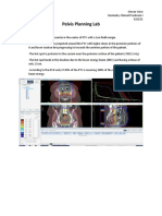 Pelvis Planning Lab: Plan 1: 6MV PA Beam With Isocenter in The Center of PTV With A 1cm Field Margin