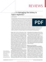 Reviews: What Is Damaging The Kidney in Lupus Nephritis?