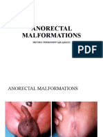 Anorectal Malformations: NM Rika Trismayanti SPB, Spba (K)