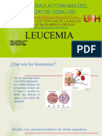 2 - Leucemia