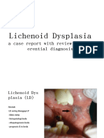 Case Report Lichenoid Displasia