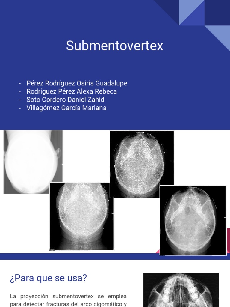 Proyección Submentovertex en Radiología | PDF | Cráneo | Sistema ...