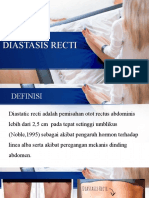 Diastetic Recti