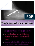 External Fixation: Pin Care and Complications
