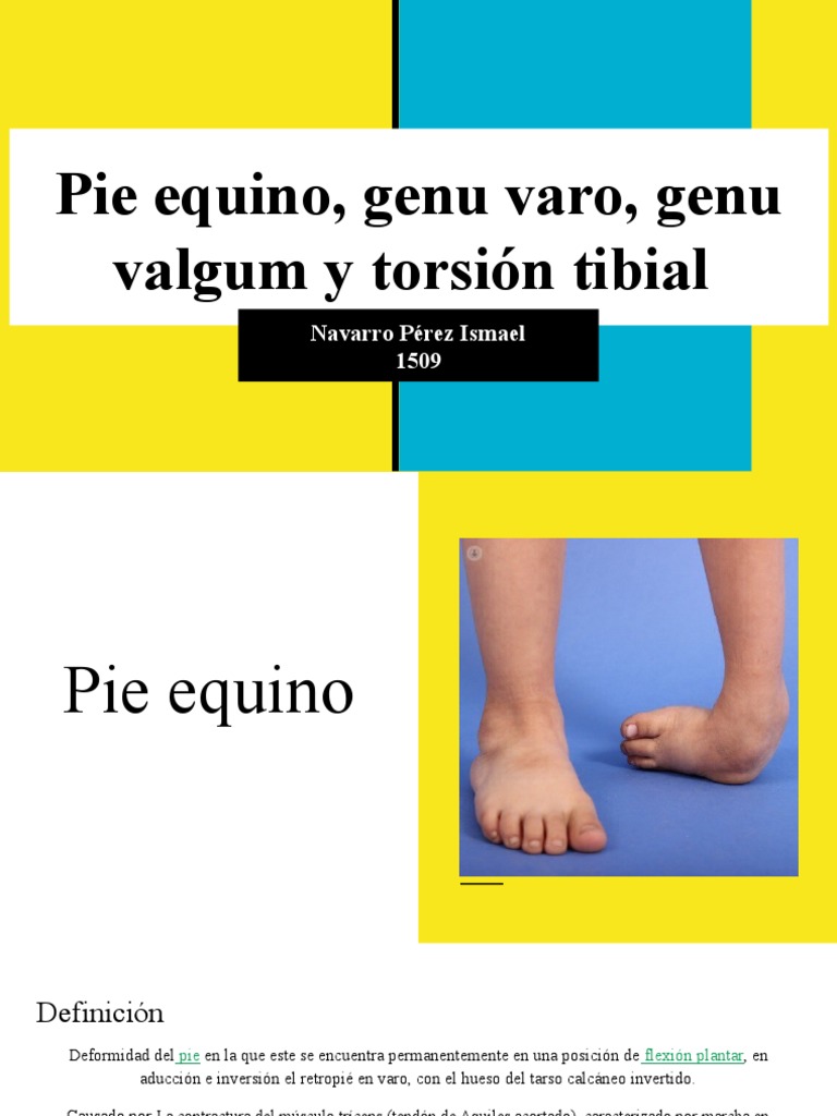 Pie Equino, Genu Varo y Valgo, Torsión Tibial PDF Rodilla Pie
