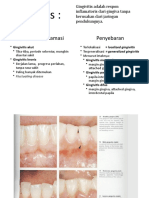 Perbedaan Gingivitis Dan Periodontitis