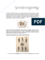 Apertura Cameral Molares