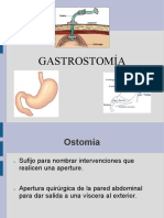 Gastrostoma 140225210442 Phpapp01
