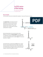 Deconstructing The ECG Curve - The Components of The Tracing: Key Concepts