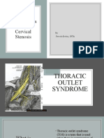 Case Study On Tos & Cervical Stenosis: by Faviola Bedoy, SPTA