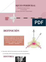 Bloqueo Peridural