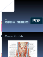 Cancerul Tiroidian