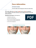 Face Deformities: Hemifacial Microsomia
